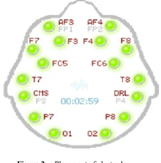 Figure 2.  Placement of electrodes 