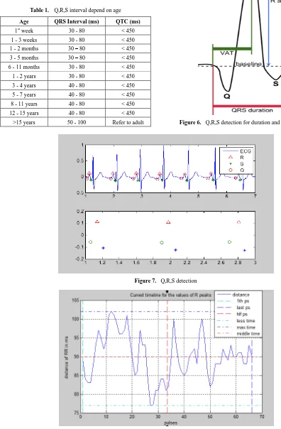 Table 1.  Q,R,S interval depend on age 