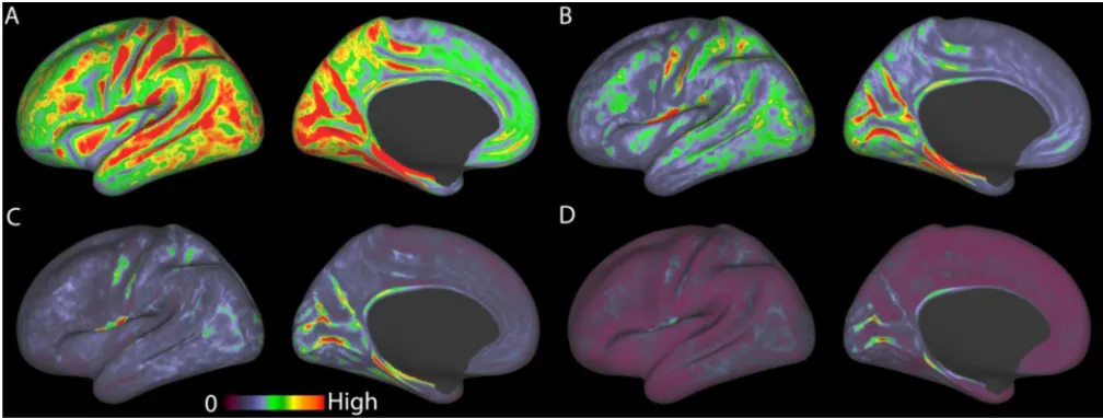 Figure 5.A comparison of the geometrical effects of various fMRI acquisition resolutions on folded