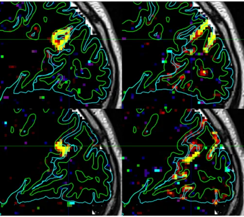 Figure 6.Illustration of the spatial specificity of the high resolution HCP fMRI acquisition and
