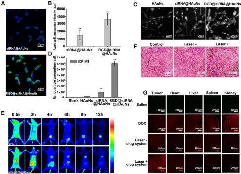 Figure 4. The tumor-targeting ability of the RGD@siRNA@DOX@HAuNs drug carrier system. (A) Laser confocal microscopy images of the cell-uptake ability of the nano-carrier with or without RGD modification; green: siRNA-FITC, blue: Hoechst
