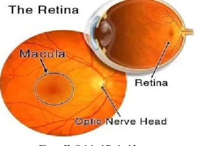 Figure II: Original Retinal Image  