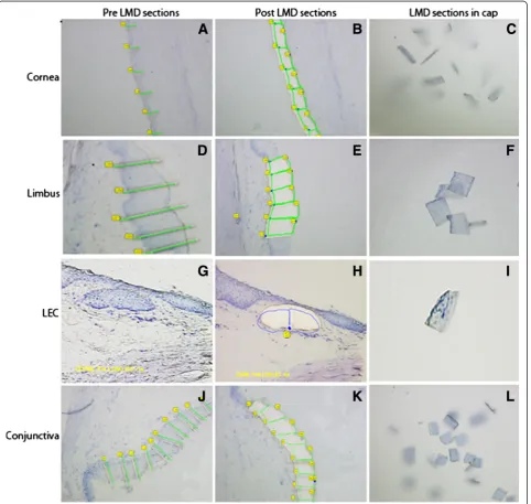 Figure 2 Laser Microdissection of OS epithelial regions. The histological OS epithelial sections used for LMD were stained with toluidine bluedye
