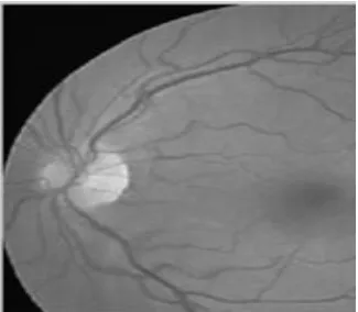 Figure 3 Cropped image  