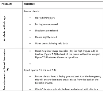 Figure 7.3 illustrates the correct position. 