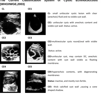 Figure 1.3: Classification of ultrasound images. CE1-CE2 cyst types are considered fully viable, CE3 cyst type is considered and classified a transitional stage, and may remain viable or regress to a non-viable stage; CE4-CE5 are degenerative , non-viable 