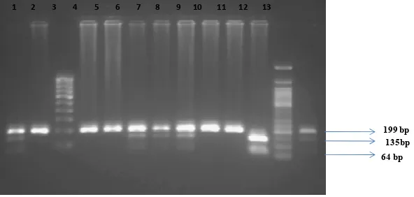 Figure 1: 3% agarose gel electropherogramshowing restriction digestion pattern of  Q192R polymorphism of PON1 gene region using of Alw I restriction enzyme