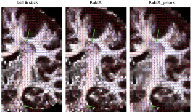 Fig. 10.Coronal views of mean estimated orientations of two fiber compartments for different