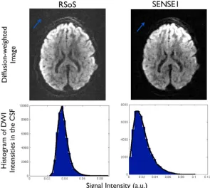 Figure 1.Top: Raw magnitude diffusion-weighted images reconstructed using RSoS and SENSE1