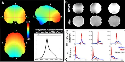 Figure 2.A) Spatial variations in the b value of a [1 0 0] gradient (intended b=3000 s/mm