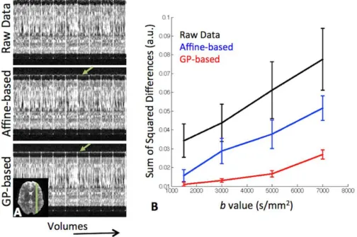 Figure 7.Comparison between correction methods for eddy current-induced distortions. A) One-