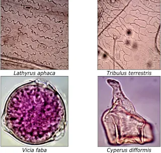 Fig. 1. Some Photographs from Slides of Pollen and Leaf Epidermal Anatomy  