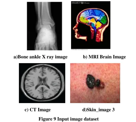 Figure 9 Input image dataset 