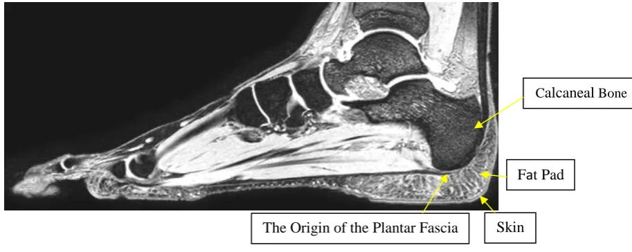 Figure 2.1: Sagittal view of the human heel area ‎