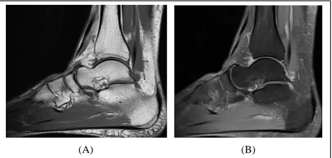 Figure 3.4: Difference between T1 and T2 weighted MR images: (A) T1 weighted; (B) T2 ‎