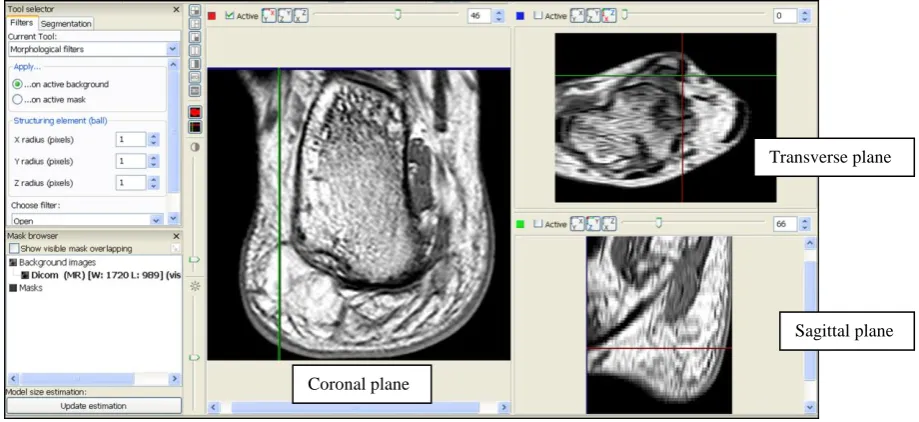 Figure 3.7: The MRI data in three views. ‎