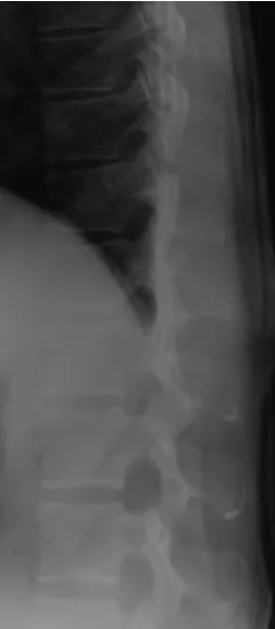 Figure 4. This gives a lateral thoraco-lumbar exposure of one of the human living volunteers using the identified optimised combination of acquisition parameter settings (i.e
