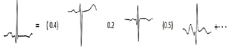 Fig. 3. A normal heartbeat is a linear combination of ICA bases with Coefficients, e.g.(-0.4)·ai+(0.2)·aj+0.5·ak+..