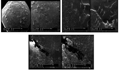 Figure 4: Charite SEM images (left to right (clock wise): increase in magnification) of 