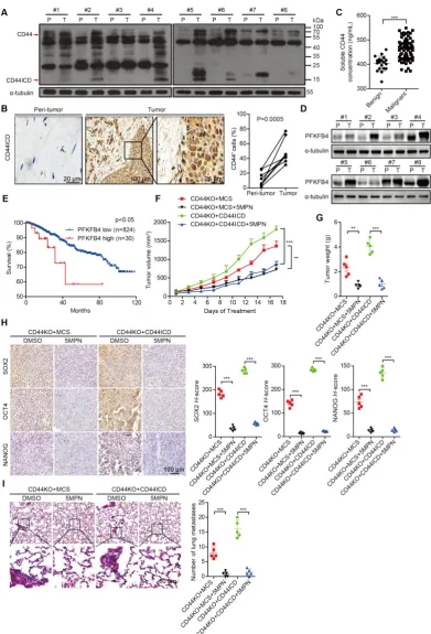 Figure 6. CD44ICD and PFKFB4 levels correlate with clinical malignancy of breast cancer patients and 5MPN inhibits tumor development