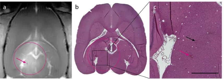 Figure 5: Histological analysis of ACT+A+E treatment. (a) T1-FLASH image showing BBB opening after treatment (magenta circle indicates treated area; magenta arrow indicates microhemorrhage)