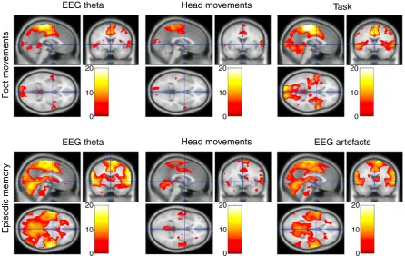 Fig. 3. Fixed effects analysis results for the foot movement (n=4; top row) and episodic memory (n=4; bottom row) task for GLM regressors that were not convolved with thecHRF