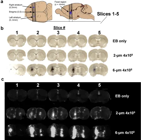 Figure 3. Imaging results. a) Location of sections used to measure Evans Blue permeabilization within left and right striatum, and brain slices analyzed for LICOR measurements