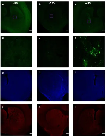 Figure 6. Co-injected dsAAV1-CMV-EGFP transduction of brain cells, and macrophage response 1 week after BBB disruption