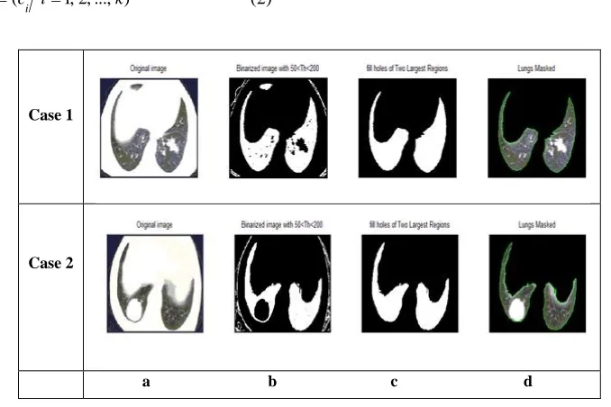 Figure (4) shows examples of K-means classification performed on two different lung's regions had cancer