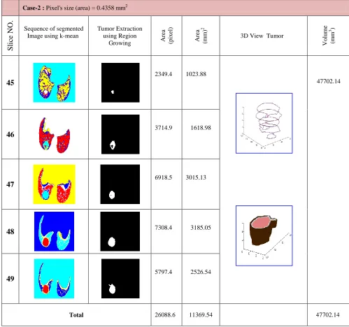 Table II  Region growing method used for tumor extraction, illustrate the 3D tumor reconstruction processes (area and volume of tumor calculation)