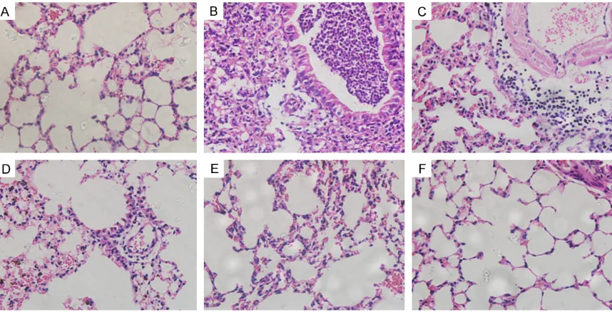 Figure 5. Pathological examinations of mouse lungs by H&E staining (×400). A: PBS group; B: asthma group; C: pcDNA3.1 group; D: pcDNA3.1-GFP group; E: pcDNA3.1-GFP-ProDer f1 group; F: pcDNA3.1-GFP-R8 group