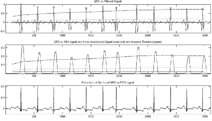 Figure 8-5 Accuracy with ICA filtering and without filtering ‎