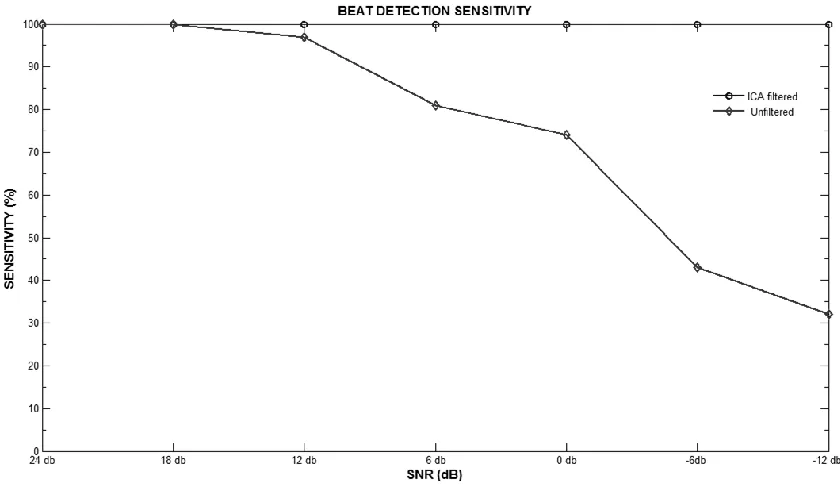 Figure 8-7 ECG QRS detection using a Pan Tomkins algorithm ‎