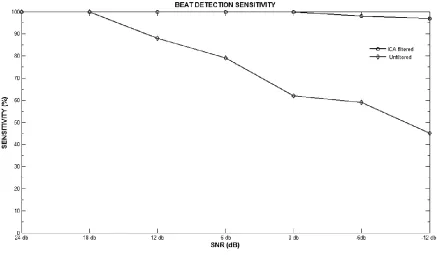 Figure ‎8-9 Beat detection comparison for Normal ECG beat with proposed ICA filtering and without filtering 