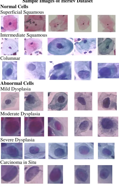 Figure 4. Sample images of the Herlev Dataset 
