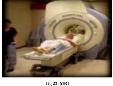 Fig 23. DBS 