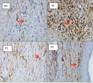 Figure 2 shows the MMP-2 expression.The red arrow shows the expression of MMP-2, 