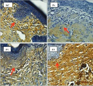 Figure 3. Expression of type 1 collagen in the vaginal wall