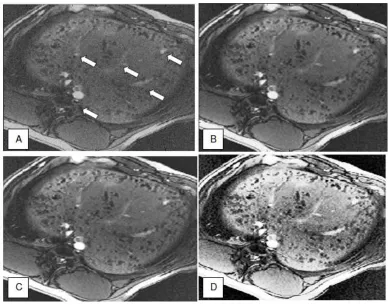 Figure 2.4 Examples of image pre-processing which have been applied in vivo cell tracking