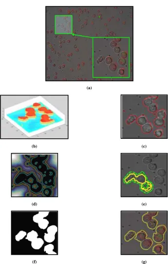 Figure 2.10 Comparison with level set and active contour[134]. (a) Original image (input image, marked by green rectangle, indicates that it needs to be processed by the proposed method and it is also compared with following segmentation (no division of th