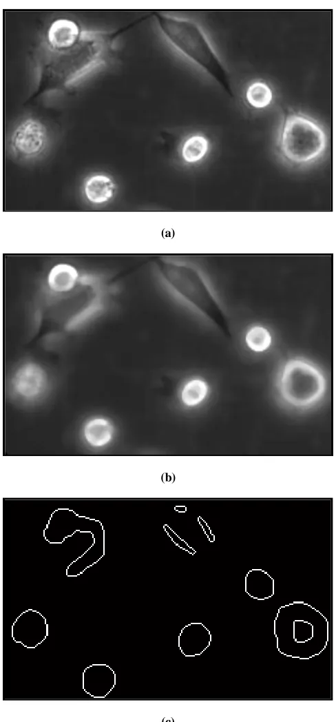Figure 2.11 (a) The original image of tongue stem cells. (b) The image after filtering