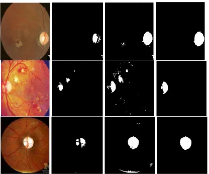 Figure 11 optical disc after the thresholding a) First column shows input images, b) Second column is gray level threshold image with HE c) Third is threshold image with BBHE, d) Last is proposed label connected threshold image with BBHE, 