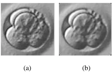Figure 3.10 Effect of median smoothing
