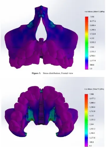Figure 3.  Stress distribution; Frontal view 