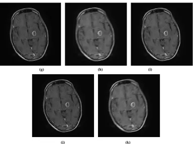 Table 3.  Comparison between SNR of motion image and corrected image (axial image) 