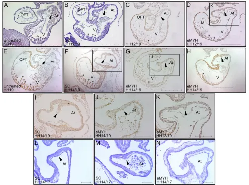 Fig. 3. Abnormal atrial and ventricular development upon eMYH knockdown. (A-K)Morpholino was applied at HH12 (B-D) or HH14 (F-H),with harvesting at HH19 for eMYH knockdowns (C,D,G,H) and controls (A,B,E,F)