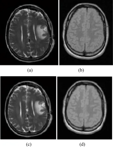 Figure 3.  (a) Original MRI image, (b) Original CT image, (c) MRI image after pre processing, (d) CT image after pre processing 