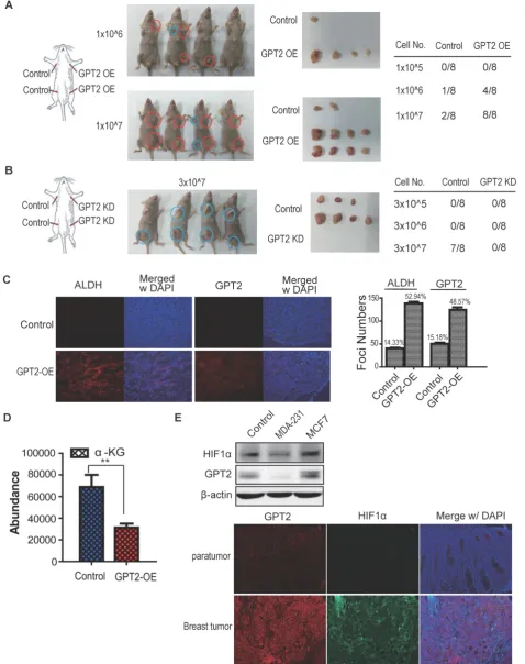 Figure 5. GPT2 promotes mammary tumorigenesis A. GPT2 overexpression promotes tumor formation of breast cancer cells