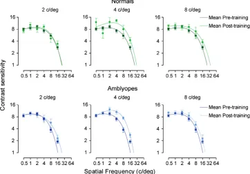 Fig. 5. Pre–post ratio plotted against spatial frequency for (a) normal observers and (b) amblyopic observers
