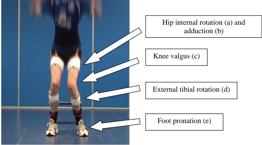 Figure 2.13 – Dynamic valgus of the lower limb 